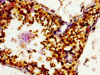 Immunohistochemistry of paraffin-embedded human testis tissue using SLC16A12 Antibody at dilution of 1:100Rabbit anti-Human SLC16A12 Polyclonal Antibody