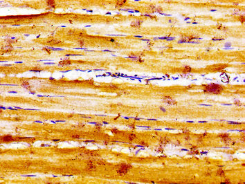 Immunohistochemistry of paraffin-embedded human skeletal muscle tissue using SLC16A12 Antibody at dilution of 1:100Rabbit anti-Human SLC16A12 Polyclonal Antibody