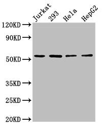 Western Blot  | Positive WB detected in: Jurkat whole cell lysate, 293 whole cell lysate, Hela whole cell lysate, HepG2 whole cell lysate  | All lanes: SLC16A12 antibody at 3µg/ml  | Secondary  | Goat polyclonal to rabbit IgG at 1/50000 dilution  | Predicted band size: 54 kDa  | Observed band size: 54 kDaRabbit anti-Human SLC16A12 Polyclonal Antibody