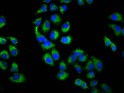 Immunofluorescence staining of Hela cells with UBR3 Antibody at 1:200, counter-stained with DAPI. The cells were fixed in 4% formaldehyde, permeabilized using 0.2% Triton X-100 and blocked in 10% normal Goat Serum. The cells were then incubated with the antibody overnight at 4°C. The secondary antibody was Alexa Fluor 488-congugated AffiniPure Goat Anti-Rabbit IgG(H+L).Rabbit anti-Human UBR3 Polyclonal Antibody