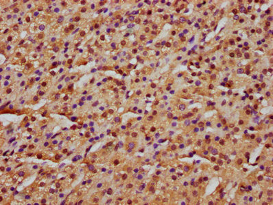 IHC image of UBR3 Antibody diluted at 1:600 and staining in paraffin-embedded human adrenal gland tissue performed on a Leica BondTM system. After dewaxing and hydration, antigen retrieval was mediated by high pressure in a citrate buffer (pH 6.0). Section was blocked with 10% normal goat serum 30min at RT. Then primary antibody (1% BSA) was incubated at 4°C overnight. The primary is detected by a biotinylated secondary antibody and visualized using an HRP conjugated SP system.Rabbit anti-Human UBR3 Polyclonal Antibody