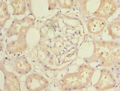 Immunohistochemistry of paraffin-embedded human kidney tissue using CFAP65 Antibody at dilution of 1:100Rabbit anti-Human CFAP65 Polyclonal Antibody