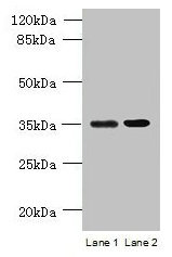 Western blot  | All lanes: CFAP65 antibody at 8µg/ml  | Lane 1: U251 whole cell lysate  | Lane 2: U87 whole cell lysate  | Secondary  | Goat polyclonal to rabbit IgG at 1/10000 dilution  | Predicted band size: 218, 19, 82, 88 kDa  | Observed band size: 35 kDaRabbit anti-Human CFAP65 Polyclonal Antibody