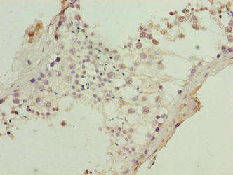 Immunohistochemistry of paraffin-embedded human testis tissue using KRT80 Antibody at dilution of 1:100