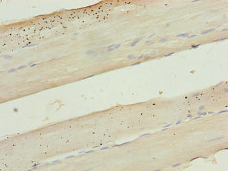 Immunohistochemistry of paraffin-embedded human skeletal muscle tissue using KRT80 Antibody at dilution of 1:100