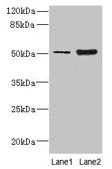 Western blot  | All lanes: KRT80 antibody at 2µg/ml  | Lane 1: A549 whole cell lysate  | Lane 2: Mouse brain tissue  | Secondary  | Goat polyclonal to rabbit IgG at 1/10000 dilution  | Predicted band size: 51, 48, 55 kDa  | Observed band size: 51 kDa