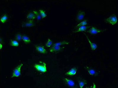 Immunofluorescent analysis of U251 cells using SLC25A25 Antibody at dilution of 1:100 and Alexa Fluor 488-congugated AffiniPure Goat Anti-Rabbit IgG(H+L)Rabbit anti-Human SLC25A25 Polyclonal Antibody
