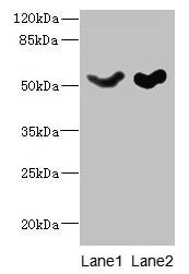 Western blot  | All lanes: SLC25A25 antibody at 10µg/ml  | Lane 1: Mouse liver tissue  | Lane 2: Mouse brain tissue  | Secondary  | Goat polyclonal to rabbit IgG at 1/10000 dilution  | Predicted band size: 53, 56, 57, 55, 41 kDa  | Observed band size: 53 kDaRabbit anti-Human SLC25A25 Polyclonal Antibody