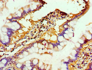 Immunohistochemistry of paraffin-embedded human small intestine tissue using ALKBH2 Antibody at dilution of 1:100Rabbit anti-Human ALKBH2 Polyclonal Antibody