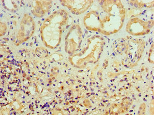 Immunohistochemistry of paraffin-embedded human kidney tissue using ALKBH2 Antibody at dilution of 1:100Rabbit anti-Human ALKBH2 Polyclonal Antibody