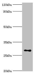 Western blot | All lanes: Alpha-ketoglutarate-dependent dioxygenase alkB homolog 2 antibody at 2μg/ml + Hela whole cell lysate | Secondary | Goat polyclonal to rabbit IgG at 1/10000 dilution | Predicted band size: 30, 18 kDa | Observed band size: 30 kDaRabbit anti-Human ALKBH2 Polyclonal Antibody
