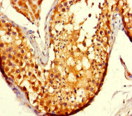 Immunohistochemistry of paraffin-embedded human testis tissue using Adck2 Antibody at dilution of 1:100Rabbit anti-Mus musculus (Mouse) Adck2 Polyclonal Antibody