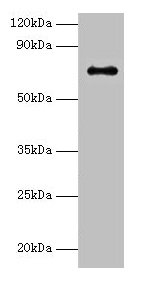 Western blot  | All lanes: Adck2 antibody at 2µg/ml + K562 whole cell lysate  | Secondary  | Goat polyclonal to rabbit IgG at 1/15000 dilution  | Predicted band size: 69 kDa  | Observed band size: 69 kDaRabbit anti-Mus musculus (Mouse) Adck2 Polyclonal Antibody