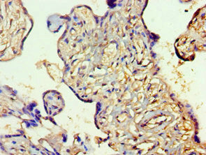 Immunohistochemistry of paraffin-embedded human placenta tissue using SLC27A4 Antibody at dilution of 1:100Rabbit anti-Human SLC27A4 Polyclonal Antibody