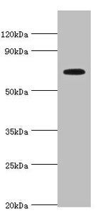 Western blot | All lanes: Long-chain fatty acid transport protein 4 antibody at 8μg/ml + Mouse heart tissue | Secondary | Goat polyclonal to rabbit IgG at 1/10000 dilution | Predicted band size: 73, 27 kDa | Observed band size: 73 kDaRabbit anti-Human SLC27A4 Polyclonal Antibody