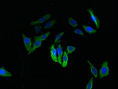 Immunofluorescent analysis of HepG2 cells using TXNDC11 Antibody at dilution of 1:100 and Alexa Fluor 488-congugated AffiniPure Goat Anti-Rabbit IgG(H+L)Rabbit anti-Human TXNDC11 Polyclonal Antibody