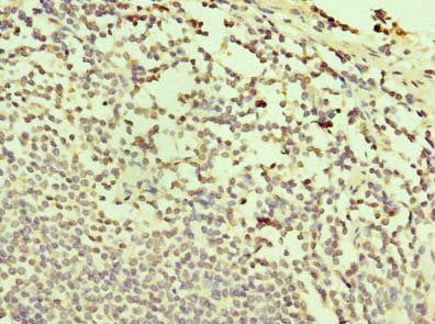 Immunohistochemistry of paraffin-embedded human small intestine tissue using the antibody at dilution of 1:100Rabbit anti-Human TXNDC11 Polyclonal Antibody