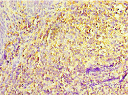 Immunohistochemistry of paraffin-embedded human tonsil tissue using IL27RA Antibody at dilution of 1:100Rabbit anti-Human IL27RA Polyclonal Antibody