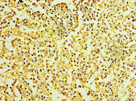 Immunohistochemistry of paraffin-embedded human spleen tissue using IL27RA Antibody at dilution of 1:100Rabbit anti-Human IL27RA Polyclonal Antibody