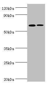 Western blot | All lanes: IL27RA antibody at 9μg/ml | Lane 1: Rat heart tissue | Lane 2: Rat brain tissue | Secondary | Goat polyclonal to rabbit IgG at 1/10000 dilution | Predicted band size: 69 kDa | Observed band size: 69 kDaRabbit anti-Human IL27RA Polyclonal Antibody