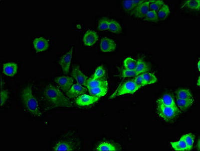 Immunofluorescent analysis of MCF-7 cells using HACD2 Antibody at dilution of 1:100 and Alexa Fluor 488-congugated AffiniPure Goat Anti-Rabbit IgG(H+L)Rabbit anti-Human HACD2 Polyclonal Antibody