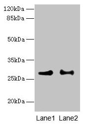 Western blot  | All lanes: HACD2 antibody at 4µg/ml  | Lane 1: MCF-7 whole cell lysate  | Lane 2: LO2 whole cell lysate  | Secondary  | Goat polyclonal to rabbit IgG at 1/10000 dilution  | Predicted band size: 29 kDa  | Observed band size: 29 kDaRabbit anti-Human HACD2 Polyclonal Antibody
