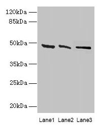 Western blot  | All lanes: HSDL2 antibody at 3µg/ml  | Lane 1: 293T whole cell lysate  | Lane 2: Hela whole cell lysate  | Lane 3: HepG2 whole cell lysate  | Secondary  | Goat polyclonal to rabbit IgG at 1/10000 dilution  | Predicted band size: 46, 38 kDa  | Observed band size: 46 kDaRabbit anti-Human HSDL2 Polyclonal Antibody