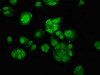 Immunofluorescence staining of MCF-7 cells with MACC1 Antibody at 1:100, counter-stained with DAPI. The cells were fixed in 4% formaldehyde, permeabilized using 0.2% Triton X-100 and blocked in 10% normal Goat Serum. The cells were then incubated with the antibody overnight at 4°C. The secondary antibody was Alexa Fluor 488-congugated AffiniPure Goat Anti-Rabbit IgG(H+L).