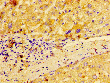 IHC image of MACC1 Antibody diluted at 1:100 and staining in paraffin-embedded human liver tissue performed on a Leica BondTM system. After dewaxing and hydration, antigen retrieval was mediated by high pressure in a citrate buffer (pH 6.0). Section was blocked with 10% normal goat serum 30min at RT. Then primary antibody (1% BSA) was incubated at 4°C overnight. The primary is detected by a biotinylated secondary antibody and visualized using an HRP conjugated SP system.