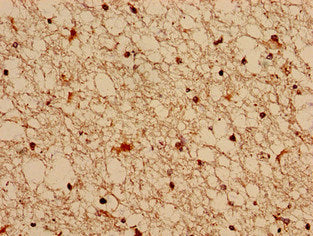 Immunocytochemistry analysis of human brain tissue using FGD6 Antibody at dilution of 1:100Rabbit anti-Human FGD6 Polyclonal Antibody