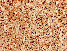 Immunocytochemistry analysis of human adrenal gland tissue using FGD6 Antibody at dilution of 1:100Rabbit anti-Human FGD6 Polyclonal Antibody