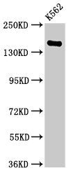 Western Blot  | Positive WB detected in: K562 whole cell lysate  | All lanes: FGD6 antibody at 2.8µg/ml  | Secondary  | Goat polyclonal to rabbit IgG at 1/50000 dilution  | Predicted band size: 161, 155 kDa  | Observed band size: 161 kDaRabbit anti-Human FGD6 Polyclonal Antibody