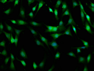 Immunofluorescence staining of NIH/3T3 cells with MOB1B Antibody at 1:400, counter-stained with DAPI. The cells were fixed in 4% formaldehyde, permeabilized using 0.2% Triton X-100 and blocked in 10% normal Goat Serum. The cells were then incubated with the antibody overnight at 4°C. The secondary antibody was Alexa Fluor 488-congugated AffiniPure Goat Anti-Rabbit IgG(H+L).Rabbit anti-Human MOB1B Polyclonal Antibody