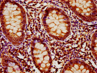 IHC image of MOB1B Antibody diluted at 1:1200 and staining in paraffin-embedded human appendix tissue performed on a Leica BondTM system. After dewaxing and hydration, antigen retrieval was mediated by high pressure in a citrate buffer (pH 6.0). Section was blocked with 10% normal goat serum 30min at RT. Then primary antibody (1% BSA) was incubated at 4°C overnight. The primary is detected by a biotinylated secondary antibody and visualized using an HRP conjugated SP system.Rabbit anti-Human MOB1B Polyclonal Antibody