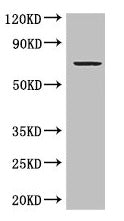 Western Blot  | Positive WB detected in: MCF-7 whole cell lysate  | All lanes: GRAMD4 antibody at 5µg/ml  | Secondary  | Goat polyclonal to rabbit IgG at 1/50000 dilution  | Predicted band size: 67, 11 kDa  | Observed band size: 67 kDaRabbit anti-Human GRAMD4 Polyclonal Antibody