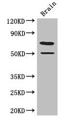 Western Blot  | Positive WB detected in: Mouse brain tissue  | All lanes: GRAMD4 antibody at 3.4µg/ml  | Secondary  | Goat polyclonal to rabbit IgG at 1/50000 dilution  | Predicted band size: 67, 11 kDa  | Observed band size: 67 kDaRabbit anti-Human GRAMD4 Polyclonal Antibody