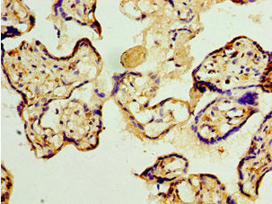 Immunohistochemistry of paraffin-embedded human placenta tissue using TET2 Antibody at dilution of 1:100Rabbit anti-Human TET2 Polyclonal Antibody
