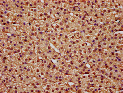 IHC image of TTI2 Antibody diluted at 1:100 and staining in paraffin-embedded human adrenal gland tissue performed on a Leica BondTM system. After dewaxing and hydration, antigen retrieval was mediated by high pressure in a citrate buffer (pH 6.0). Section was blocked with 10% normal goat serum 30min at RT. Then primary antibody (1% BSA) was incubated at 4°C overnight. The primary is detected by a biotinylated secondary antibody and visualized using an HRP conjugated SP system.Rabbit anti-Human TTI2 Polyclonal Antibody