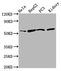 Western Blot  | Positive WB detected in: Hela whole cell lysate, HepG2 whole cell lysate, PC-3 whole cell lysate, Rat kidney tissue  | All lanes: TTI2 antibody at 8.7µg/ml  | Secondary  | Goat polyclonal to rabbit IgG at 1/50000 dilution  | Predicted band size: 57 kDa  | Observed band size: 57 kDaRabbit anti-Human TTI2 Polyclonal Antibody