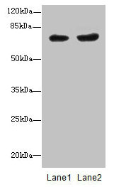 Western blot  | All lanes: PGM2L1 antibody at 0.8µg/ml  | Lane 1: HL60 whole cell lysate  | Lane 2: MCF-7 whole cell lysate  | Secondary  | Goat polyclonal to rabbit IgG at 1/10000 dilution  | Predicted band size: 71 kDa  | Observed band size: 71 kDaRabbit anti-Human PGM2L1 Polyclonal Antibody