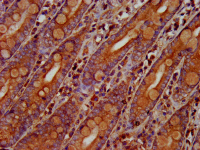 IHC image of OLFM4 Antibody diluted at 1:300 and staining in paraffin-embedded human small intestine tissue performed on a Leica BondTM system. After dewaxing and hydration, antigen retrieval was mediated by high pressure in a citrate buffer (pH 6.0). Section was blocked with 10% normal goat serum 30min at RT. Then primary antibody (1% BSA) was incubated at 4°C overnight. The primary is detected by a biotinylated secondary antibody and visualized using an HRP conjugated SP system.Rabbit anti-Human OLFM4 Polyclonal Antibody