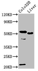 Western Blot | Positive WB detected in: Colo320 whole cell lysate, Rat liver tissue | All lanes: OLFM4 antibody at 10μg/ml | Secondary | Goat polyclonal to rabbit IgG at 1/50000 dilution | Predicted band size: 58 kDa | Observed band size: 58 kDaRabbit anti-Human OLFM4 Polyclonal Antibody