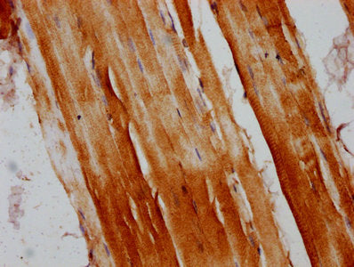 IHC image of RANBP10 Antibody diluted at 1:200 and staining in paraffin-embedded human skeletal muscle tissue performed on a Leica BondTM system. After dewaxing and hydration, antigen retrieval was mediated by high pressure in a citrate buffer (pH 6.0). Section was blocked with 10% normal goat serum 30min at RT. Then primary antibody (1% BSA) was incubated at 4°C overnight. The primary is detected by a biotinylated secondary antibody and visualized using an HRP conjugated SP system.Rabbit anti-Human RANBP10 Polyclonal Antibody