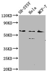 Western Blot  | Positive WB detected in: SH-SY5Y whole cell lysate, Hela whole cell lysate, MCF-7 whole cell lysate  | All lanes: RANBP10 antibody at 2.1μg/ml  | Secondary  | Goat polyclonal to rabbit IgG at 1/50000 dilution  | Predicted band size: 68, 59, 65 kDa  | Observed band size: 68 kDaRabbit anti-Human RANBP10 Polyclonal Antibody