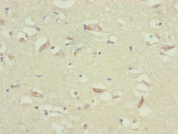 Immunohistochemistry of paraffin-embedded human brain tissue using TTLL7 Antibody at dilution of 1:100Rabbit anti-Human TTLL7 Polyclonal Antibody