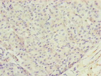 Immunohistochemistry of paraffin-embedded human pancreatic tissue using TTLL7 Antibody at dilution of 1:100Rabbit anti-Human TTLL7 Polyclonal Antibody