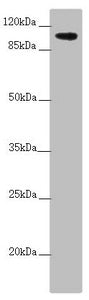 Western blot  | All lanes: TTLL7 antibody at 2.6µg/ml + A549 whole cell lysate  | Secondary  | Goat polyclonal to rabbit IgG at 1/10000 dilution  | Predicted band size: 103, 78, 93 kDa  | Observed band size: 103 kDaRabbit anti-Human TTLL7 Polyclonal Antibody