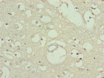 Immunohistochemistry of paraffin-embedded human brain tissue using TTLL7 Antibody at dilution of 1:100Rabbit anti-Human TTLL7 Polyclonal Antibody
