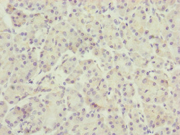 Immunohistochemistry of paraffin-embedded human pancreatic tissue using TTLL7 Antibody at dilution of 1:100Rabbit anti-Human TTLL7 Polyclonal Antibody