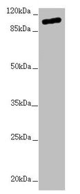 Western blot  | All lanes: TTLL7 antibody at 2.04µg/ml + Hela whole cell lysate  | Secondary  | Goat polyclonal to rabbit IgG at 1/10000 dilution  | Predicted band size: 103, 78, 93 kDa  | Observed band size: 103 kDaRabbit anti-Human TTLL7 Polyclonal Antibody
